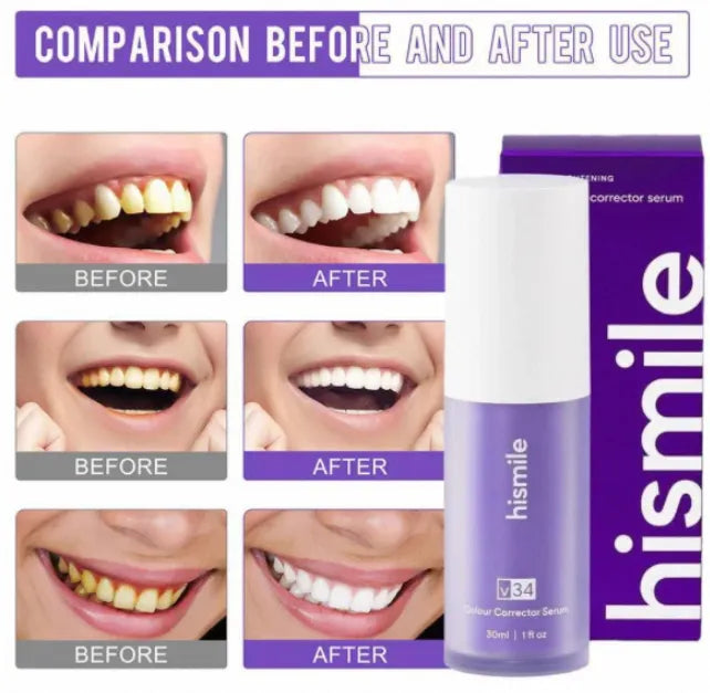 Hismiles - Teeth Brightening Serum V34 (Imported)